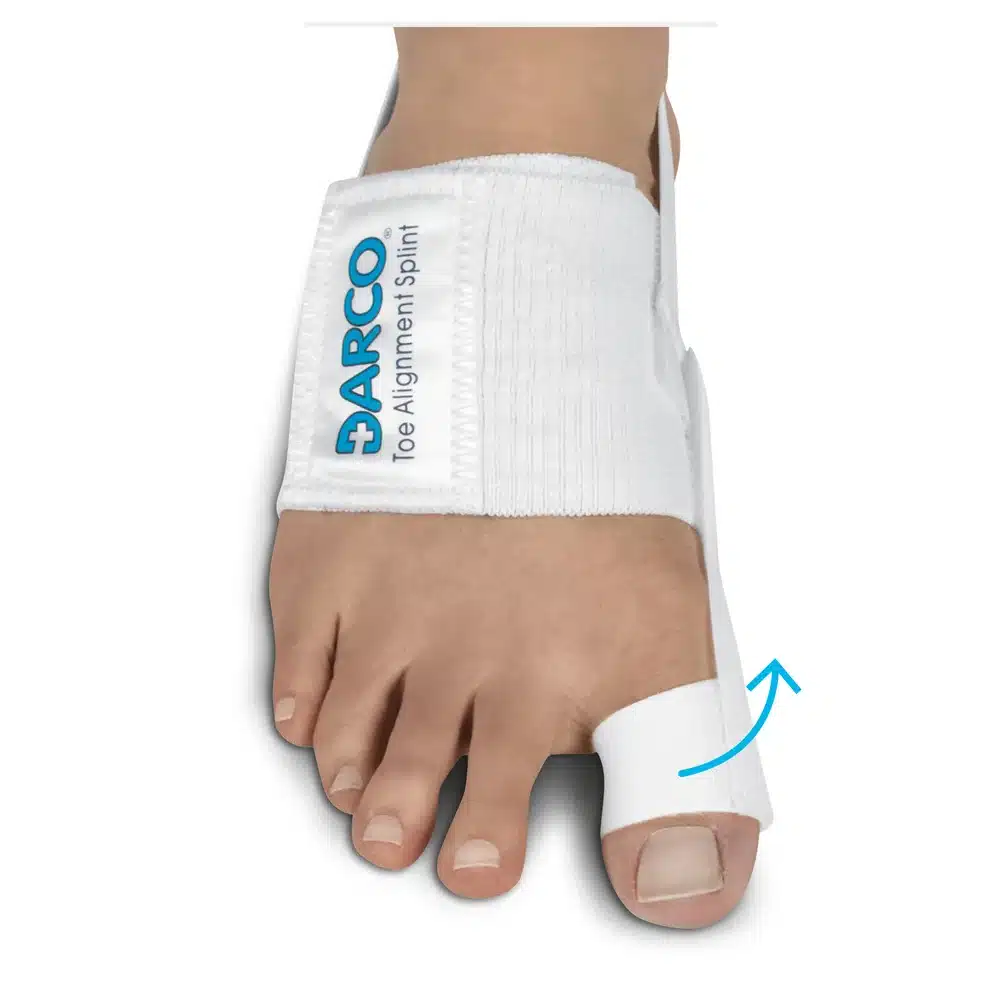 Orthèses hallux valgus