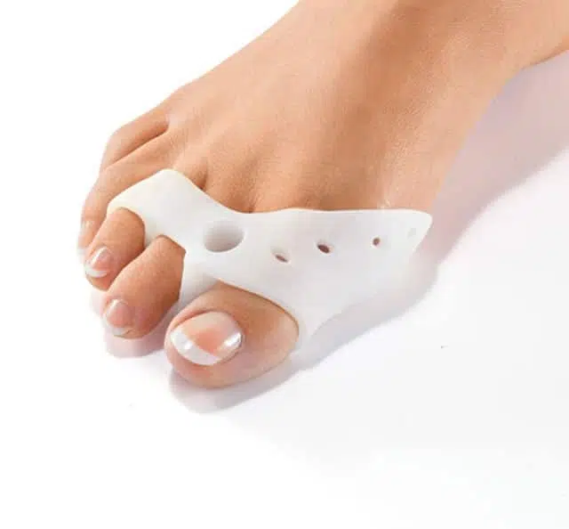 Hallux valgus